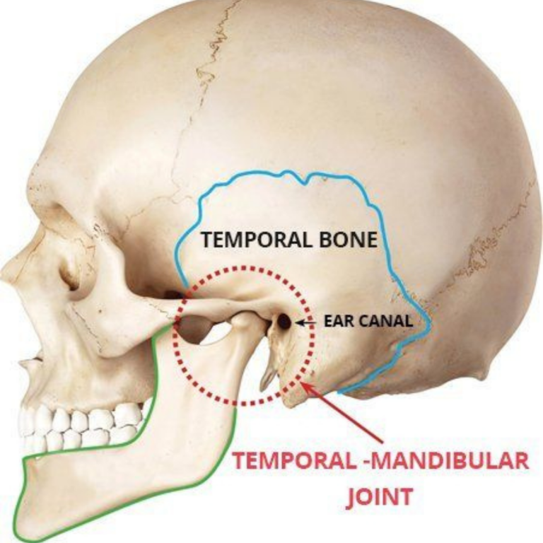 TMJ Disorders